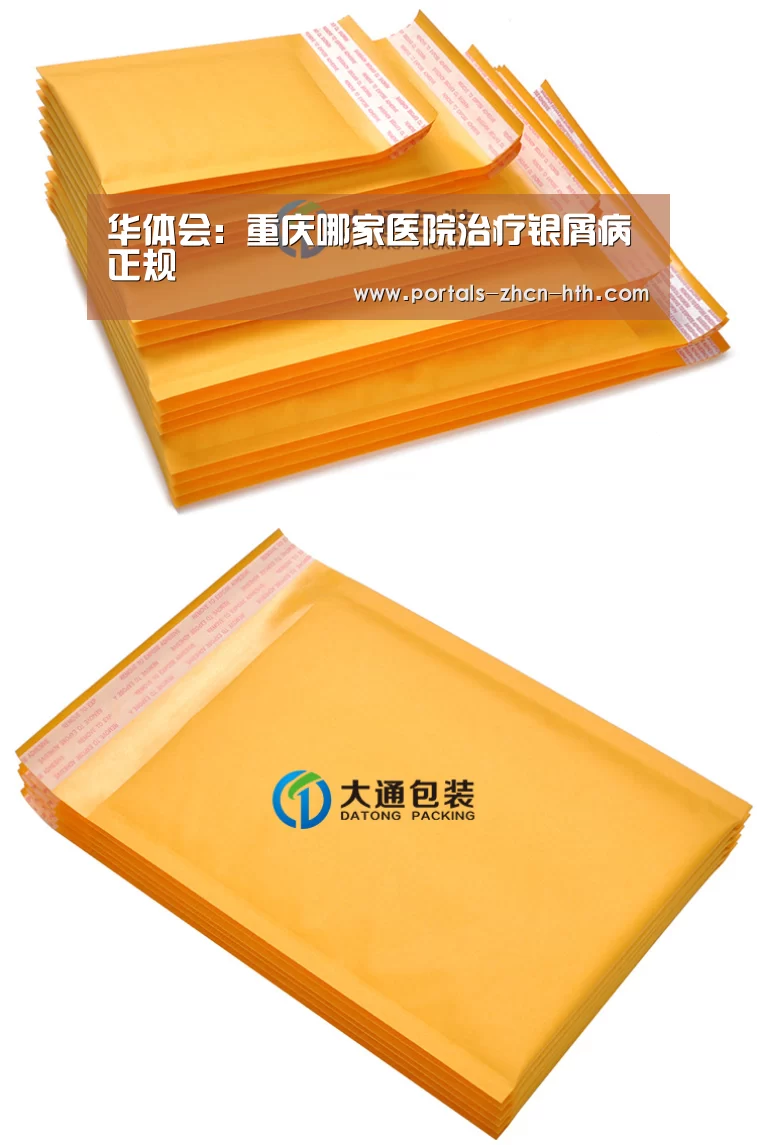 华体会:重庆哪家医院治疗银屑病正规(图2) 华体会app